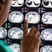 кейс сайт нейрохирурга