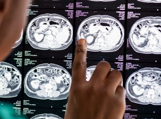 кейс сайт нейрохирурга