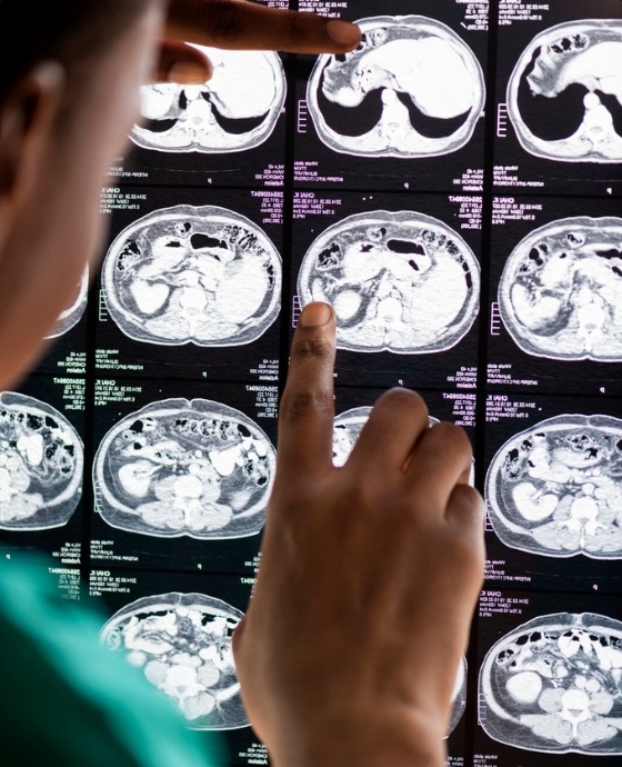 кейс сайт нейрохирурга